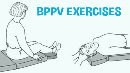 BPPV Exercises For Recovering From Vertigo